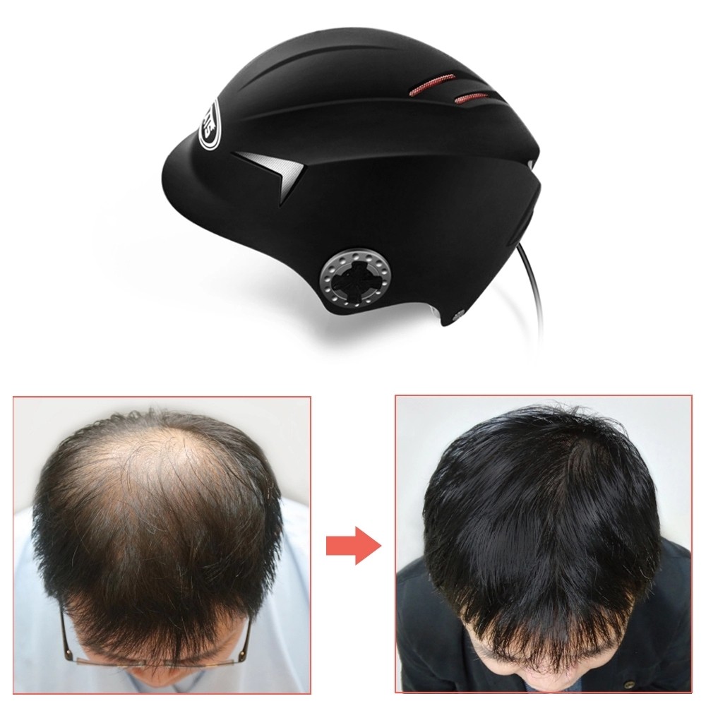 Hair Loss Treatment Product Laser Hair Regrowth Helmet, Fast Regrow Laser Growth Hair Cap