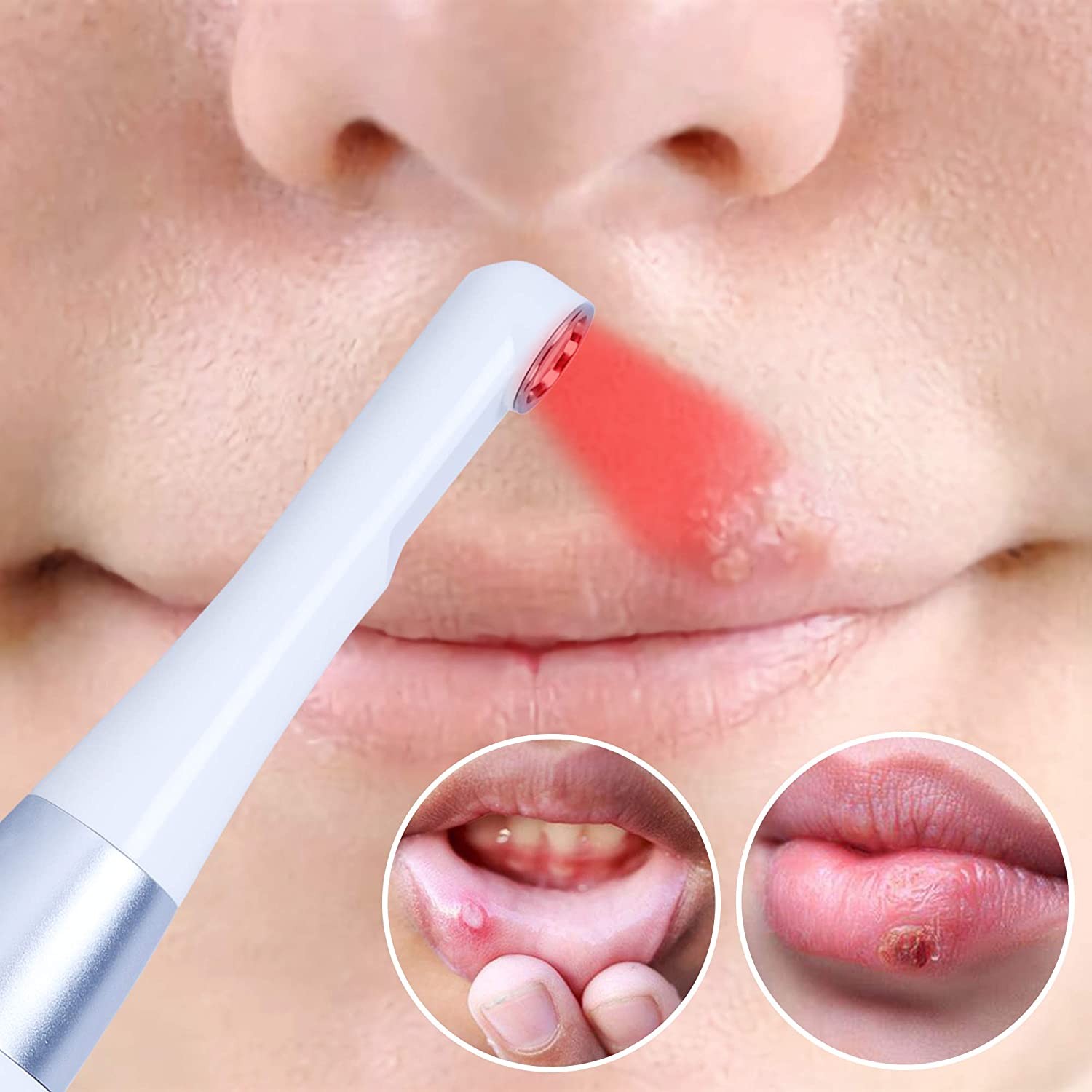 Red Light Therapy Devices 660nm 850nm Red Light Therapy For Cold Sore And Canker Sore for mouth